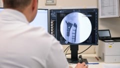 Die ärztliche Auswertung der Röntgen- oder Tomografiebilder wird immer häufiger von externen ...