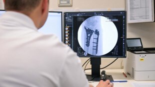 Die ärztliche Auswertung der Röntgen- oder Tomografiebilder wird immer häufiger von externen ...