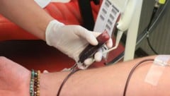 Da Blutspender in Österreich derzeit nicht verpflichtend auf Hepatitis E getestet werden, sehen ...
