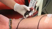 Da Blutspender in Österreich derzeit nicht verpflichtend auf Hepatitis E getestet werden, sehen ...