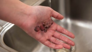 Was müssen Ersthelfer bei einem Stromschlag beachten? Experten klären für die „Krone“ auf.