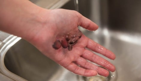 Was müssen Ersthelfer bei einem Stromschlag beachten? Experten klären für die „Krone“ auf.