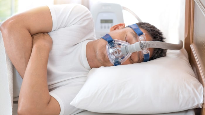Die Behandlung der Schlafapnoe erfolgt meist mit einer Atemmaske (CPAP).