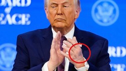 Beim genauen Betrachten der Ohren lässt sich die unechte Gesichtsbräune gut erkennen – ...