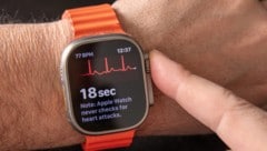 Smartwatches wie die Apple Watch bieten EKG-Aufzeichnungen.