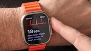 Smartwatches wie die Apple Watch bieten EKG-Aufzeichnungen.