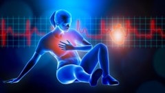 Herzgesundheit bei Frauen muss in den Fokus gerückt werden!