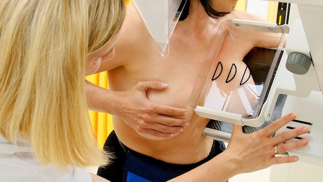 Bei Frauen ist Brustkrebs das häufigste Karzinom – umso wichtiger sind regelmäßige ...