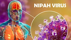 Aktuelle bestätigte Fälle in Indien alarmieren andere Länder. Wie gefährlich das Virus ist, ...