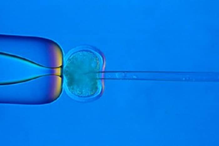 Eine Chemotherapie mit anschließendem Aufbau durch Stammzellen könnte helfen.