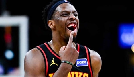 Onyeka Okongwu zeigt seine blutige Zahnlücke.