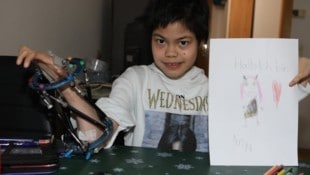 My Duyen kam mit schweren Fehlbildungen zur Welt. Essen, greifen und lernen sind für sie ...