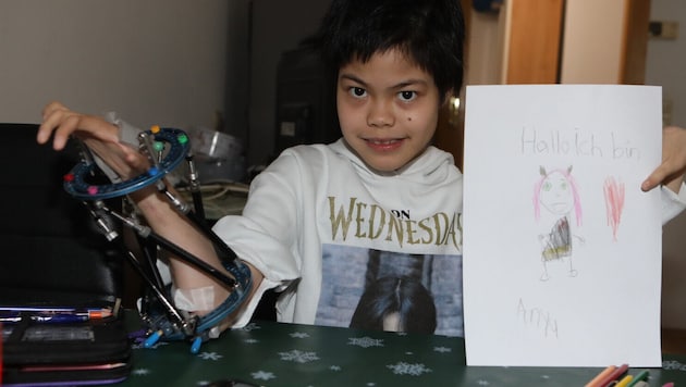 My Duyen kam mit schweren Fehlbildungen zur Welt. Essen, greifen und lernen sind für sie ...