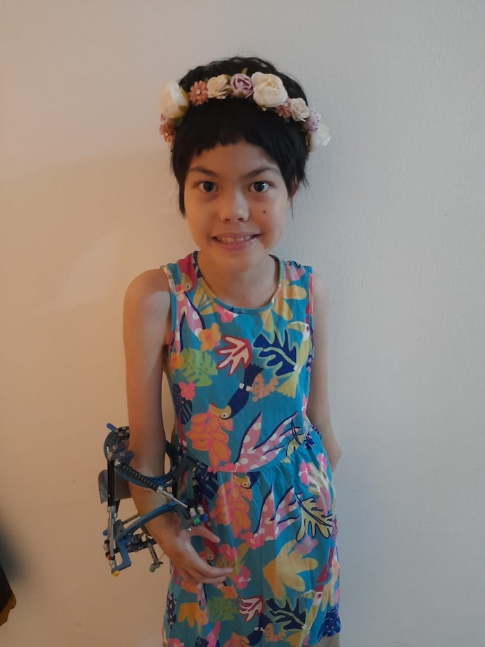 My Duyen ist zehn Jahre alt und geht ihren Alltag mit viel Geduld und Lebensmut.