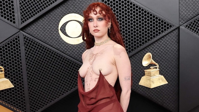 Grammys 2026 eskalieren komplett! Nippel-Alarm, Latex-Schock & XXL-Federn – DAS waren die ...