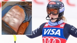 Mikaela Shiffrin sorgt mit ihrem Rücken für Staunen.