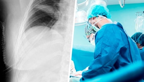 Die Ärzte rieten der Frau zu einer raschen OP – das Röntgenbild zeigt die 21 Klammern nach dem ...