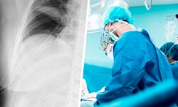 Die Ärzte rieten der Frau zu einer raschen OP – das Röntgenbild zeigt die 21 Klammern nach dem ...