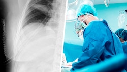 Die Ärzte rieten der Frau zu einer raschen OP – das Röntgenbild zeigt die 21 Klammern nach dem ...