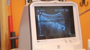 Das Unternehmen produziert Ultraschall-Geräte (Symbolbild).