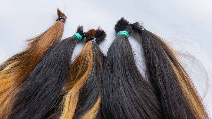 Eine Perücke kann Verbrennungsopfern ein Stück Lebensqualität zurückgeben - viele Privatpersonen ...