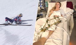 Lindsey Vonn meldet sich erstmals nach ihrem schweren Sturz mit einem Foto.