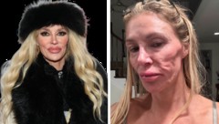 Brandi Glanville (links im Jänner 2026) hat endlich die richtige Diagnose bekommen: Als 2024 ...