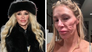 Brandi Glanville (links im Jänner 2026) hat endlich die richtige Diagnose bekommen: Als 2024 ...