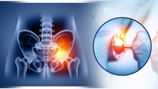 Selbst harmlos scheinende Infektionen können bei künstlichen Gelenken zum Problem werden.