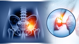 Selbst harmlos scheinende Infektionen können bei künstlichen Gelenken zum Problem werden.