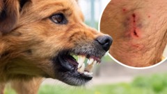 Der Biss war zwar nicht dramatisch, der Weg zum Arzt blieb aber nicht erspart.