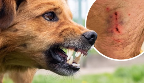 Der Biss war zwar nicht dramatisch, der Weg zum Arzt blieb aber nicht erspart.