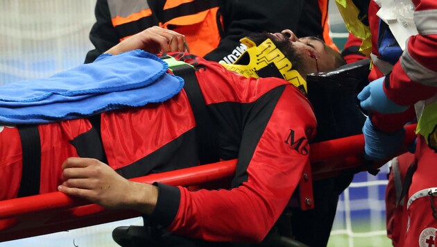 Ruben Loftus-Cheek hat sich bei einem Zusammenprall schwer verletzt.