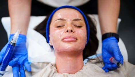 Influencerin Ana Lovrenovic bei einem Vampirlifting