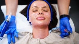 Influencerin Ana Lovrenovic bei einem Vampirlifting