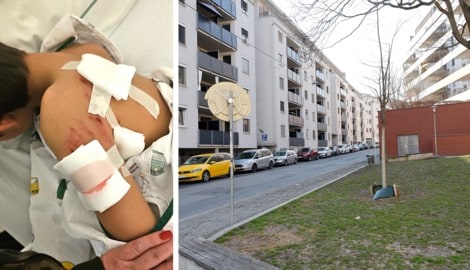 In der Grazer Niesenbergergasse attackierte am Samstagnachmittag ein Hund einen neunjährigen ...