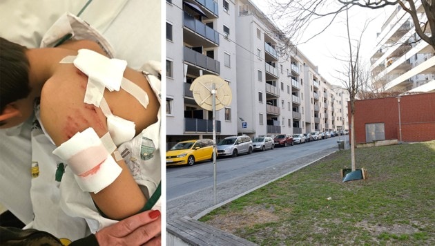 In der Grazer Niesenbergergasse attackierte am Samstagnachmittag ein Hund einen neunjährigen ...