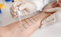 Allergien können wieder verschwinden.