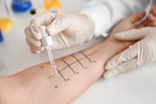 Mittels Prick-Test die Allergie austesten lassen!