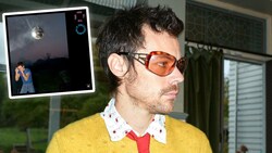 Raven bis der Arzt kommt: In bester Pop-Superstar-Tradition hat sich ex-Boyband-Schnuckel Harry ...