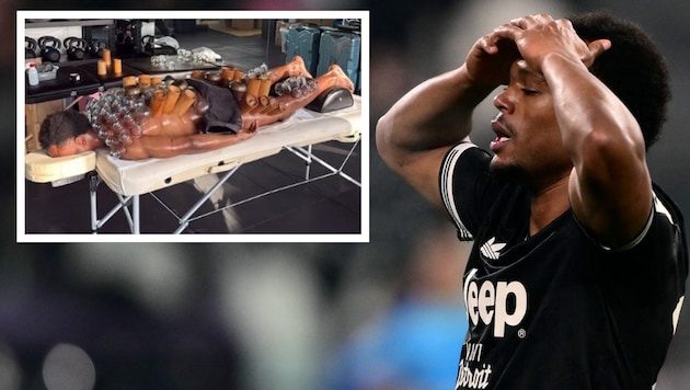 Lois Openda hofft bei Juventus Turin auf den Durchbruch. Ob die „Schröpf-Therapie“. hilft?