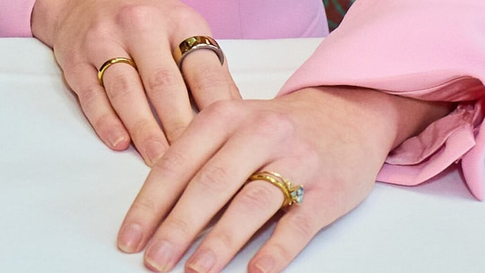 Neben der Mitgliedschaft bei der Vitiligo Hilfe Österreich verkündete Kaleen die freudige ...