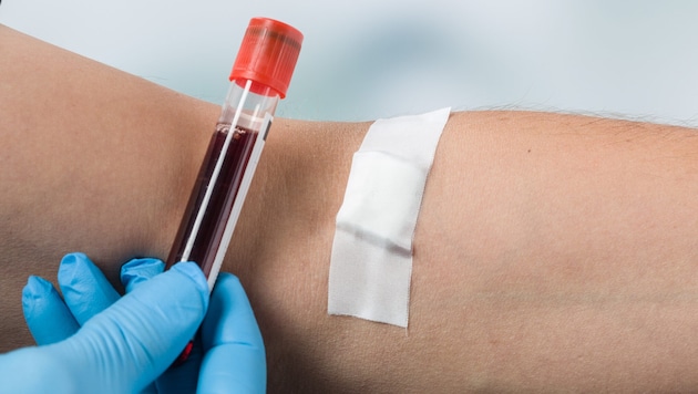 Früherkennung von Darmkrebs aus dem Blut nach weltweit neuesten wissenschaftlichen Standards ...