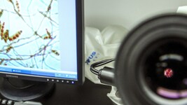 In Großbritannien sind zwei Menschen an Meningokokken gestorben, mindestens elf weitere werden ...