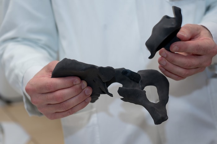 Diese künstliche Hüfte aus dem 3d-Drucker wurde der 78-Jährigen eingesetzt.