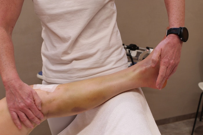 „Das hat noch viel schlimmer ausgesehen“, verrät Leonie Zegg, als sie der Krone ihr operiertes ...