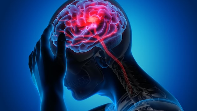 Schlaganfall wird oft als Krankheit älterer Menschen gesehen, doch es trifft auch junge.