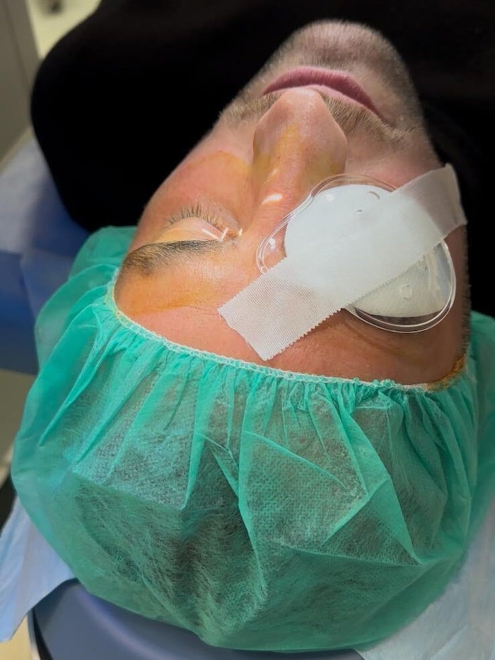 Nach der erfolgreichen Laser-OP hat Seebacher ein 160-prozentiges Sehvermögen.