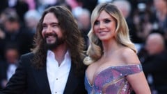 Tom Kaulitz plagen massive Schmerzen: Der Ehemann von Heidi Klum sprach nun über 