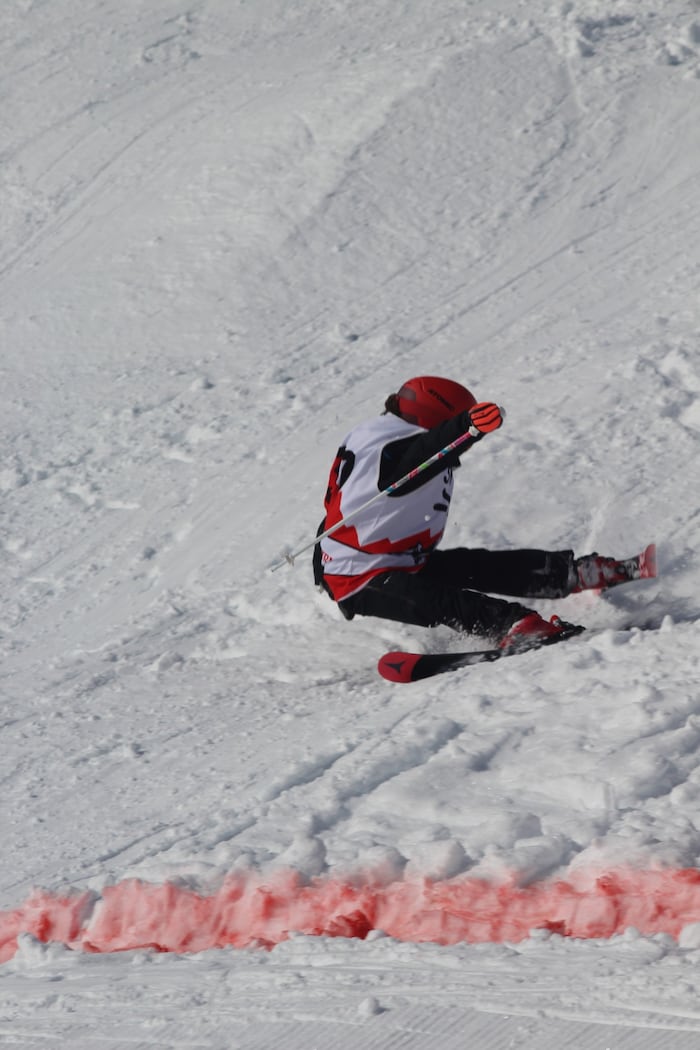 Gröbere Verletzungen gab es zum Glück nicht.